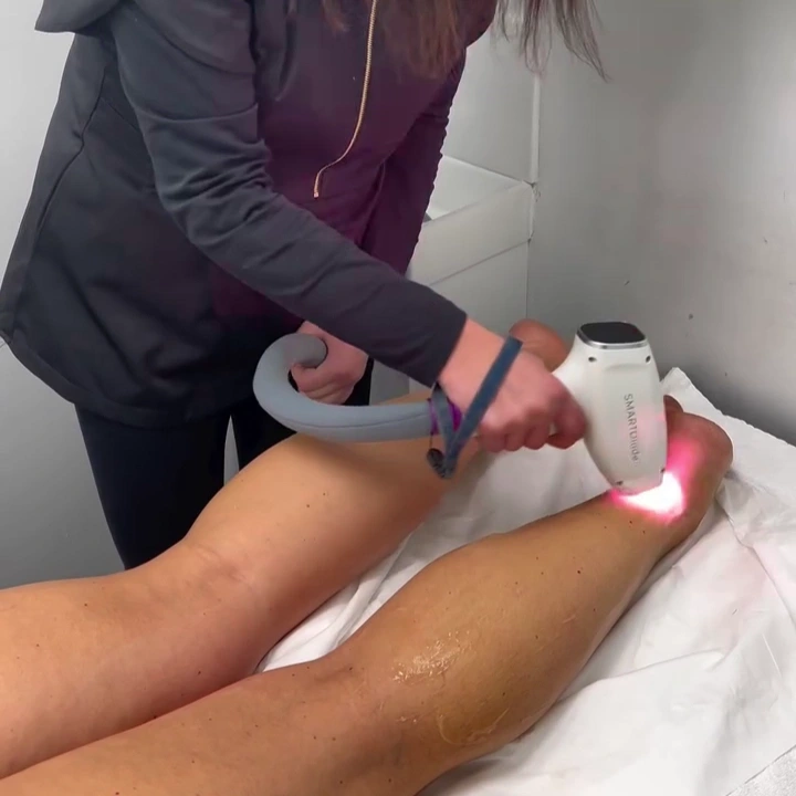 Laser hair removal treatment in progress at Lash It Up beauty salon Enfield EN1